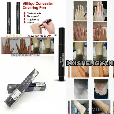 Vitiligo flomaster, фломастер для витилиго Xishengyan 1