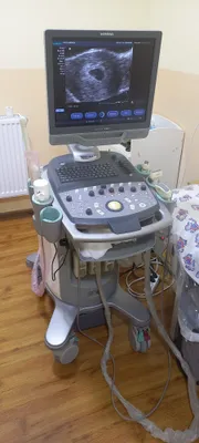 Продам б/у Узи аппарат Siemens acuson x300 1