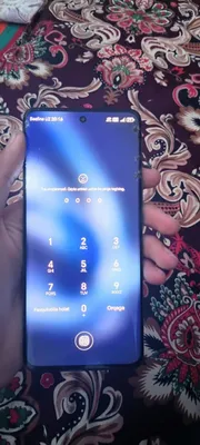 HONOR X9b sotiladi oynasi ozkina singan 1