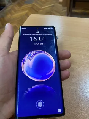 Xonor X9a 5G 1