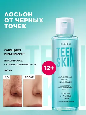 Лосьон от черных точек 1