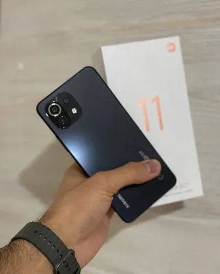 Xiomi 11 Lite Ideal 1