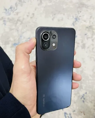 Xiaomi mi 11 lite 5g 1