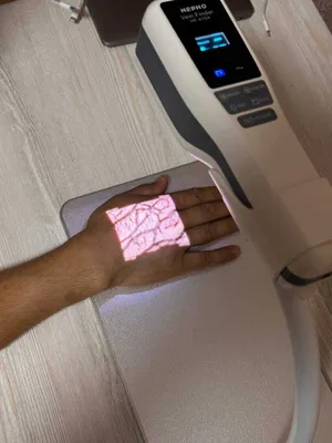 Веновизор,вено Искатель, Vein Finder, vena tomir topuvchi qurilma 1