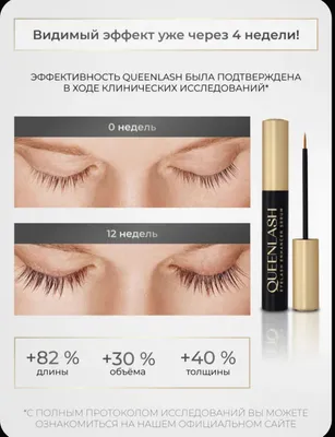 Queenlash kiprik oʻstiruvchi serum garantiyali 1