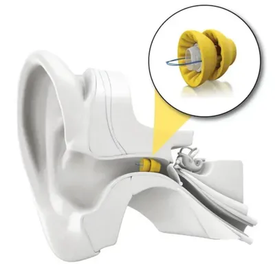 Phonak Lyric™ Eshitish apparati 1