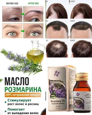Масло розмарина 1