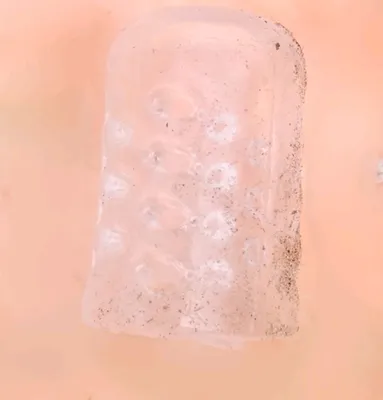 Oyoq uchun silikon barmoq qopqoqlari 1