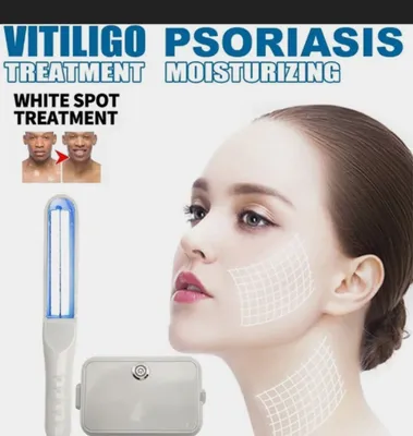 Vitiligo va psoriazni davolash uchun 311 nm lampa, yangi, original 1