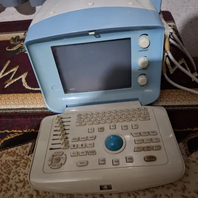 Ultratovush tekshiruvi aparati UZI I 1