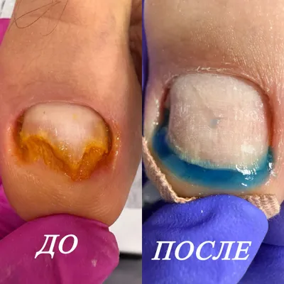 Этга усган тирноклар 1