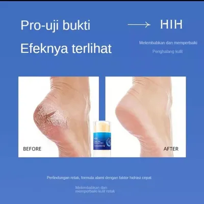 "HIH" STICK 1