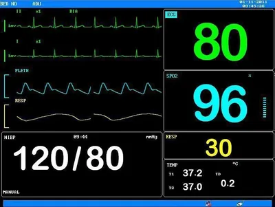 Монитор пациента, многофункциональный монитор,экг 1