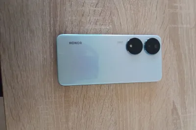 Honor X7b Telefon 1