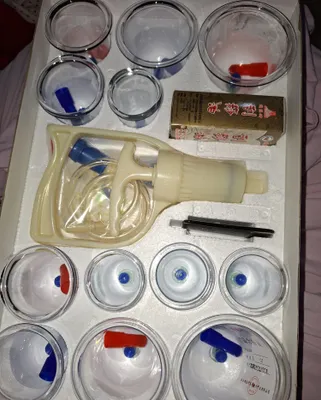 Продаётся банка для хиджамы 1