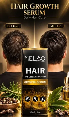 MELAO soch uchun serum 30 ml. Soch o'stiradi, soch to'kilishiga qarshi 1