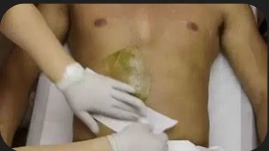 Депеляция для мужчин Депеляция для мужчин