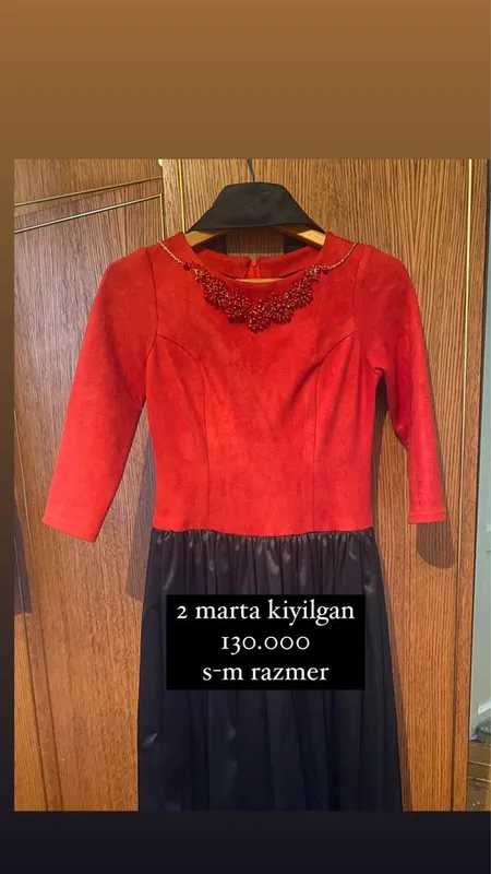 ko’ynela xolati zo’r xammasi kam kiyilgan — фото 2
