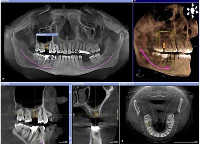 3D rentgen tish diagnostikasi | Morita 2