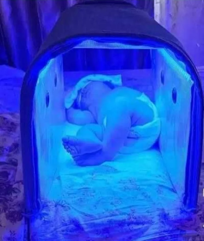 Fotolampa (фотолампа) Аренда Sariqlikni ketkazish uchun 2 Fotolampa (фотолампа) Аренда Sariqlikni ketkazish uchun 2