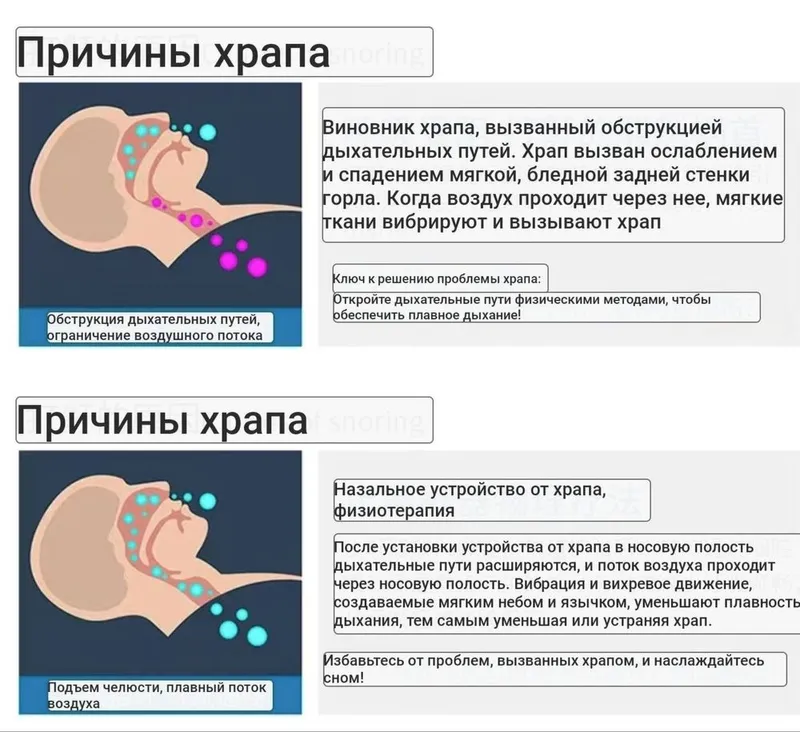 Устройство от храпа, также помогает лучше дышать. — фото 3
