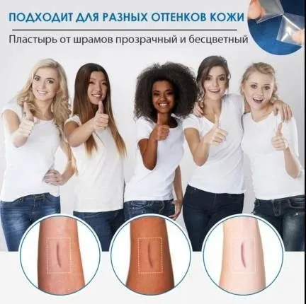 Силиконовый пластырь для шрамов 5 Силиконовый пластырь для шрамов 5
