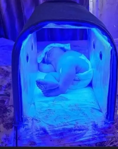 50000 Сум. Аренда лампа для новорожденных, чакалок учун лампа желтуха 2
