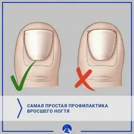 Этга усган тирноклар — фото 1
