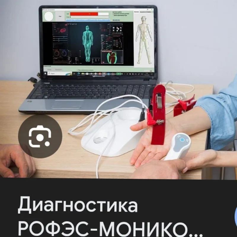 Рофес диагностика