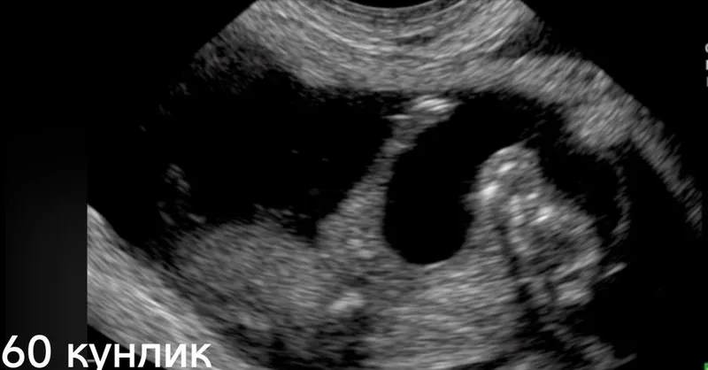 Узи диагностика хизмети 6 Узи диагностика хизмети 6