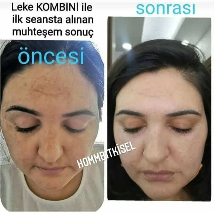 Yuz va köz atrofi uchun yangi