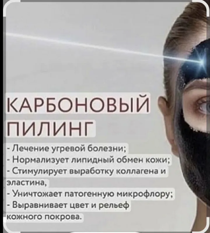 Лазерный аппарат для удаления . N yag lazer aparati. 7 Лазерный аппарат для удаления . N yag lazer aparati. 7