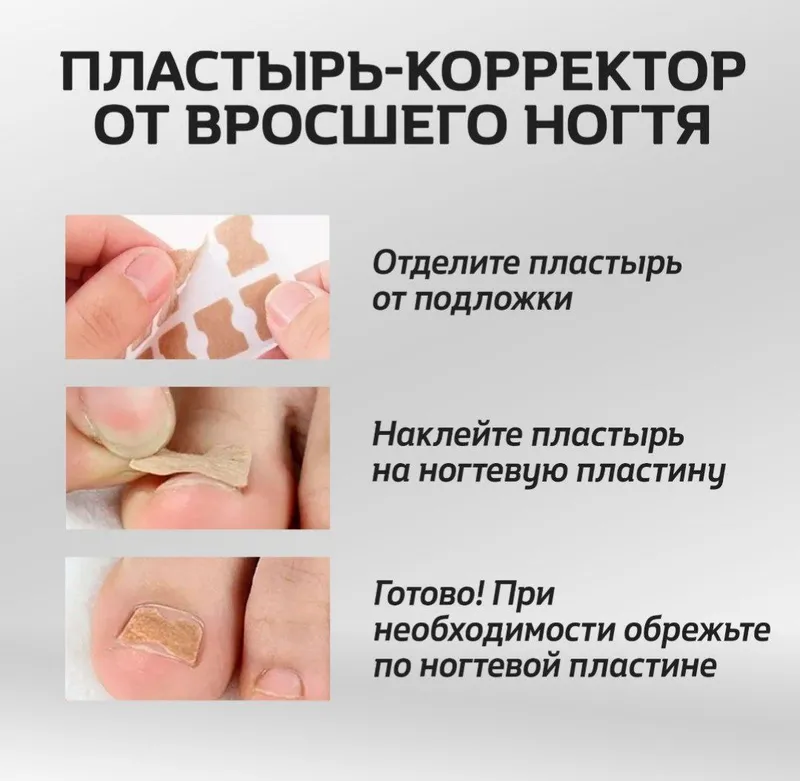 Bosh barmoqning ichga o‘sib kirgan tirnog‘i uchun plastir-korrektor 3