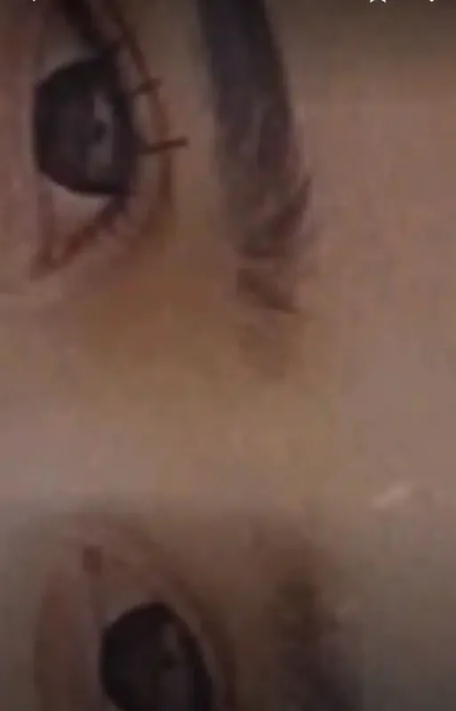 Linza koʻz uchun 4 Linza koʻz uchun 4