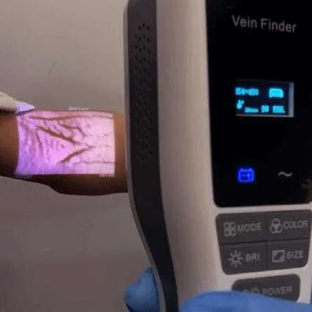 Venovizer – Vena topuvchi tibbiy qurilma | веновизор | Vein Finder Venovizer – Vena topuvchi tibbiy qurilma | веновизор | Vein Finder