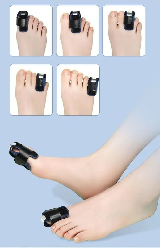 Oyoq barmoqlari uchun fiksator-ortez, gips o‘rniga korset 1 Oyoq barmoqlari uchun fiksator-ortez, gips o‘rniga korset 1