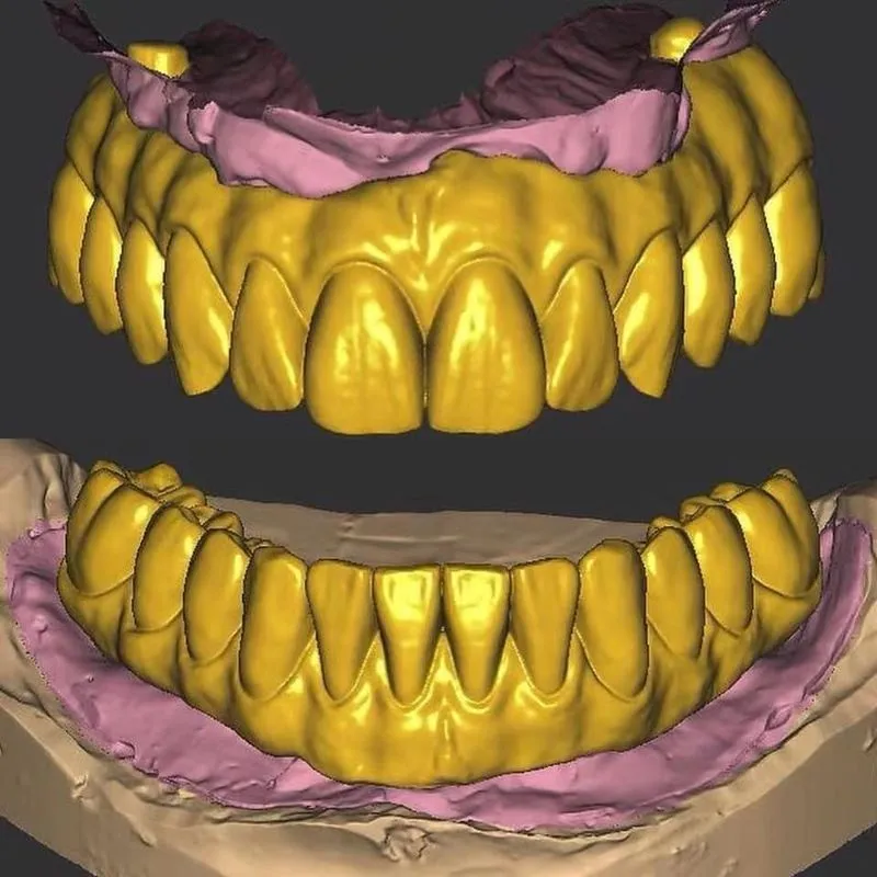 Exocad CAD/CAM | Zirkoniya va PMMA 3D modellar 2 Exocad CAD/CAM | Zirkoniya va PMMA 3D modellar 2