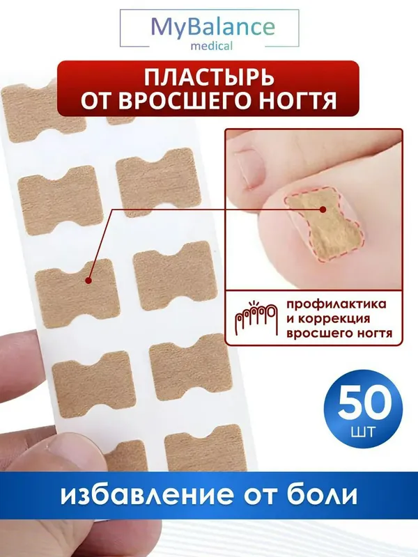 O‘sib kirgan tirnoqni tuzatish uchun plastir 2