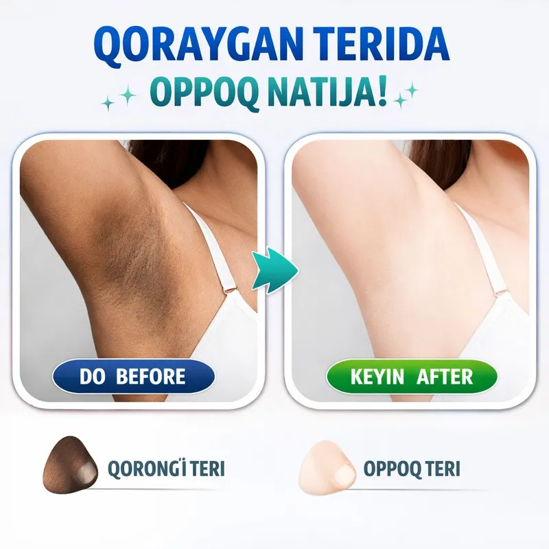 Qoraygan terini intim aʼzo oqartirish uchun Lasion