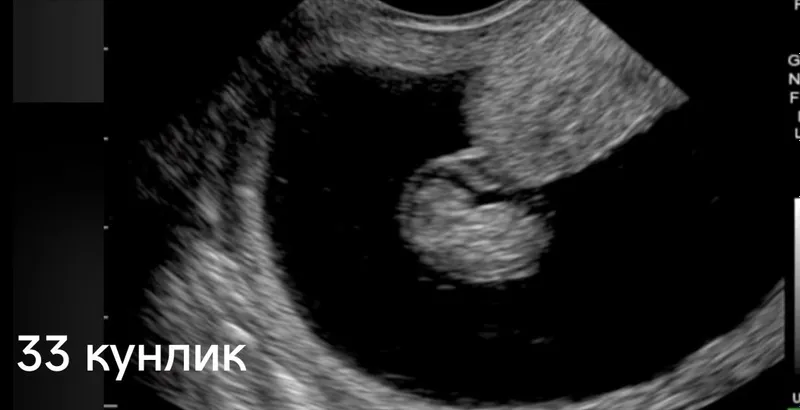 Узи диагностика хизмети 4 Узи диагностика хизмети 4