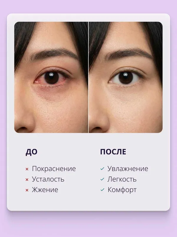 Увлажняющие капли для глаз RELINS ACTIVE с гиалуроновой кислотой, 10мл 3 Увлажняющие капли для глаз RELINS ACTIVE с гиалуроновой кислотой, 10мл 3