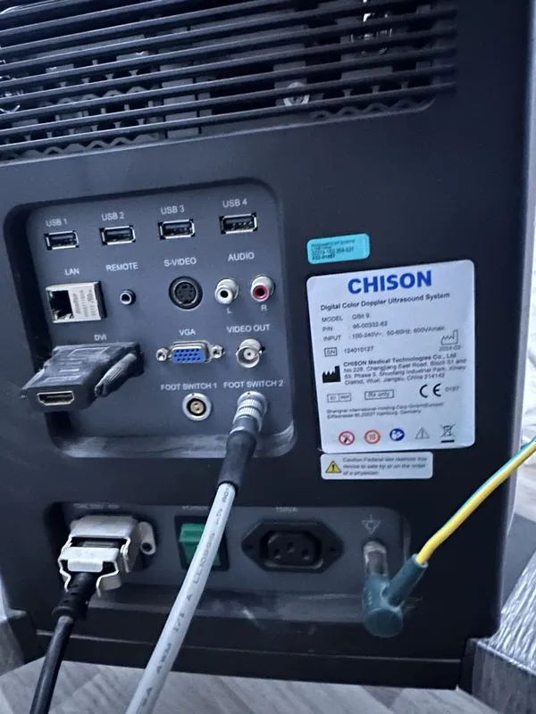 УЗИ апарат chison q bit 9 3