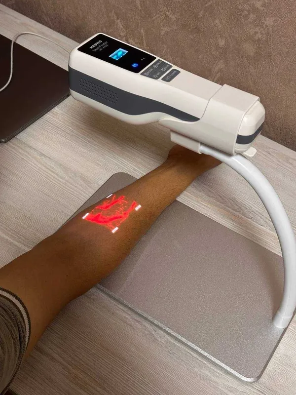 Веновизор,вено Искатель, Vein Finder, vena tomir topuvchi qurilma — фото 4
