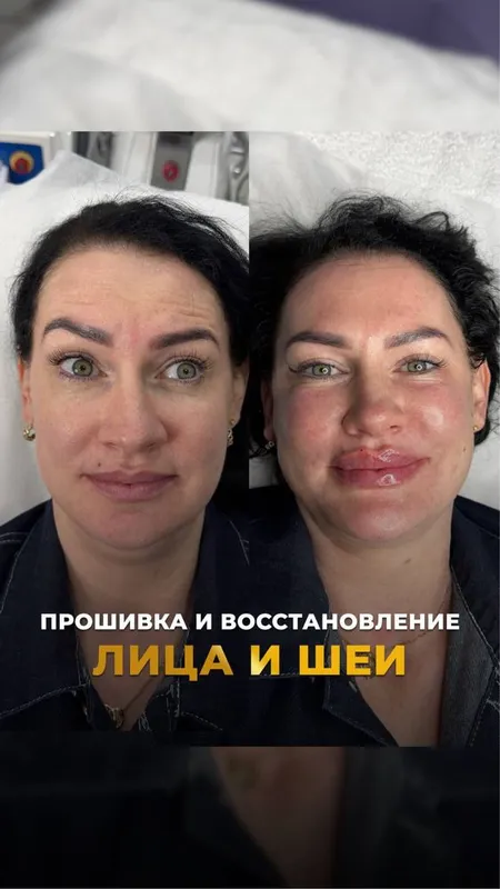 Услуги косметолога 1