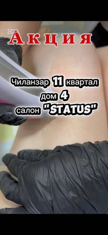 Депиляция — фото 1