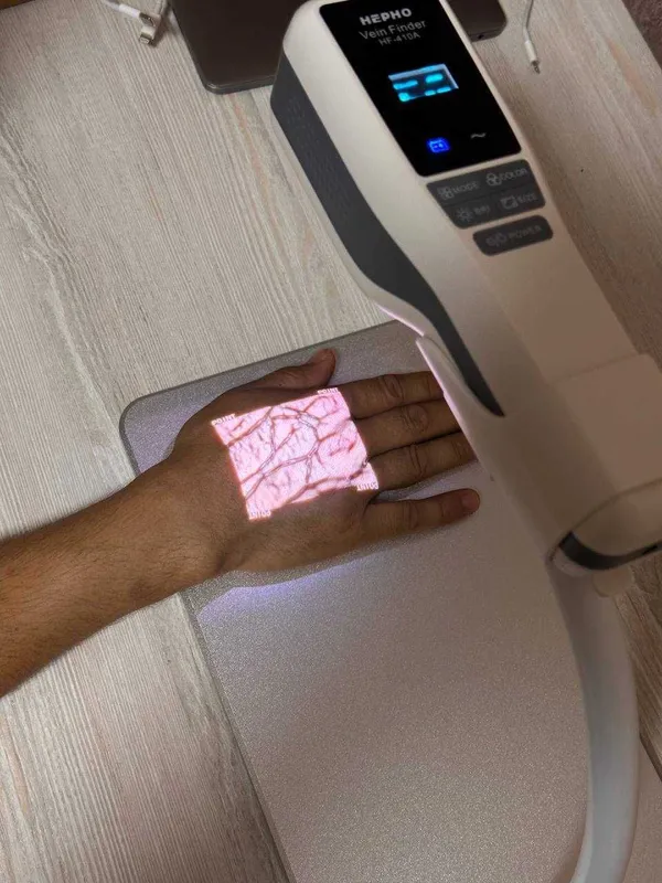 Веновизор,вено Искатель, Vein Finder, vena tomir topuvchi qurilma