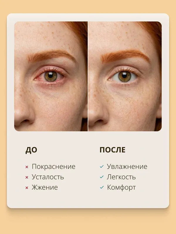 Капли глазные RELINS с витаминами А, Е, В6, 10 мл 3 Капли глазные RELINS с витаминами А, Е, В6, 10 мл 3