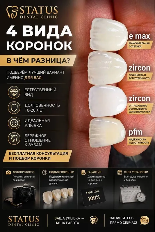 Виниры,Брекеты,Расроччка,Импланты,