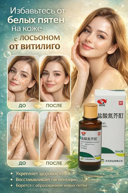 Лосьон от витилиго. Vitiligo lasyon 1