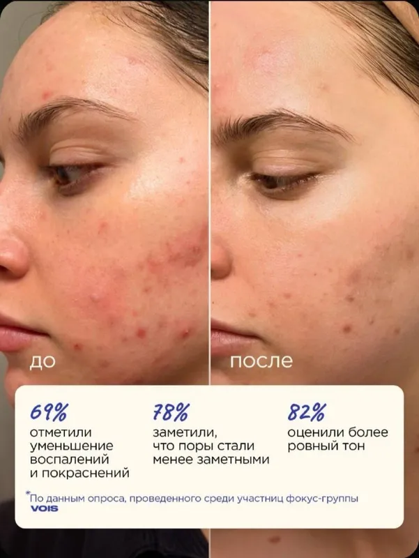 Сыворотка для ухода за кожей лица Vois, 30 мл 2 Сыворотка для ухода за кожей лица Vois, 30 мл 2